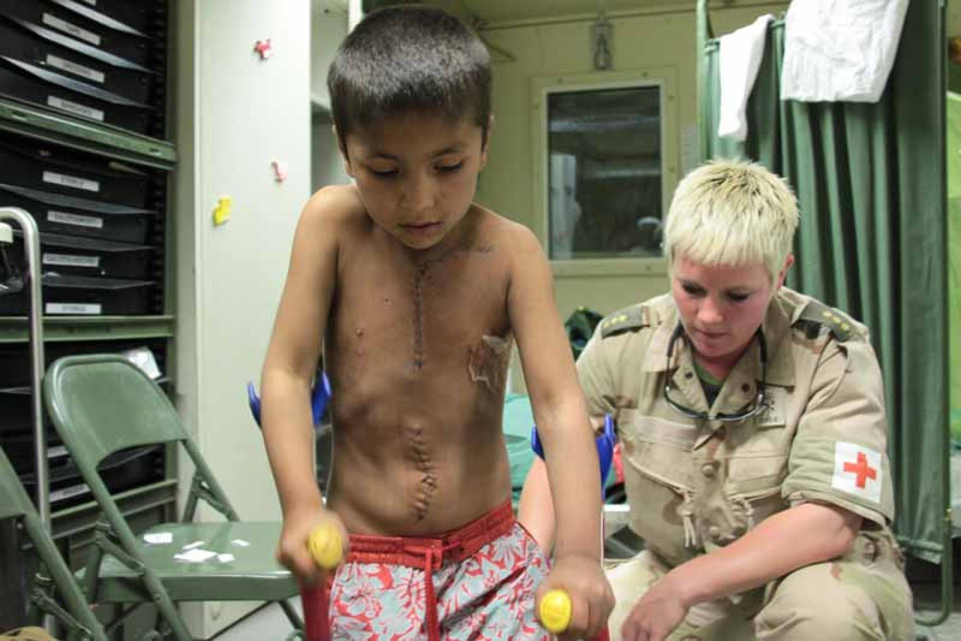 Jongetje met zwart haar en littekens leert lopen met krukken, een vrouwelijke militair helpt 